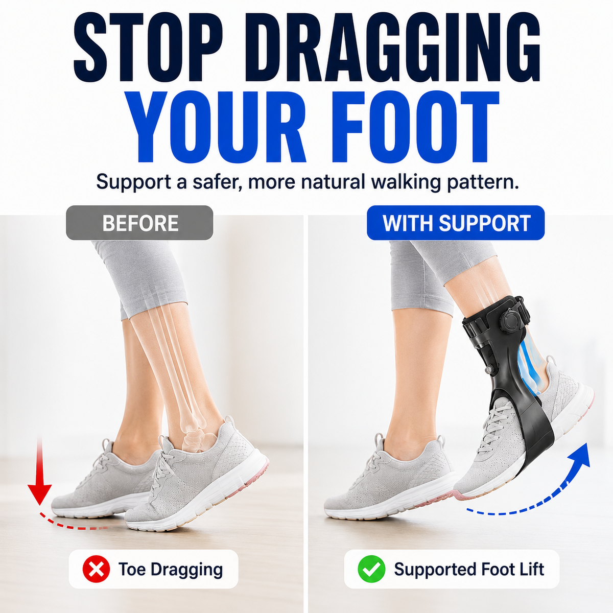Before and after comparison: toe dragging versus supported foot lift with the brace