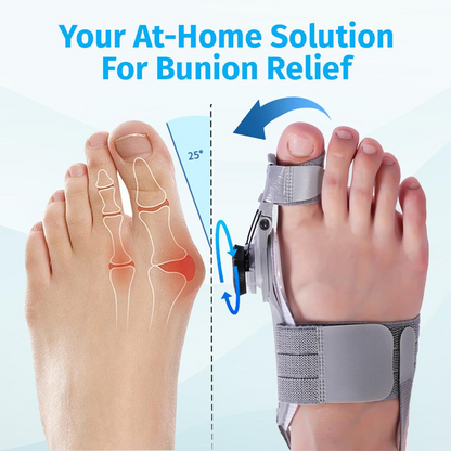 Bunion Pain? Get Relief in Just 30 Minutes a Day